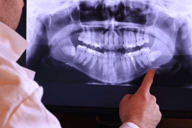 Best Walk-In Emergency Dentist in Harlowton, MT